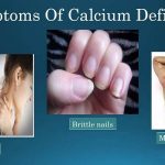 Hypocalcemia: What are The Causes and Symptoms of Calcium Deficiency?